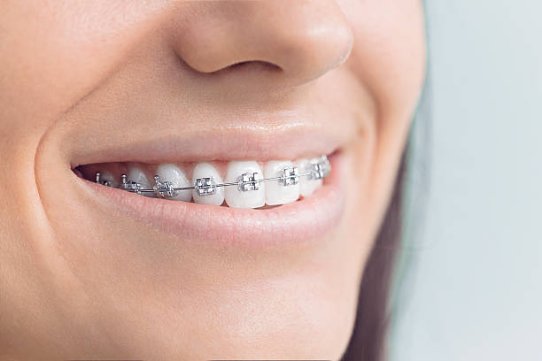 Best Invisalign and Clear Aligners  in Olivehurst, CA